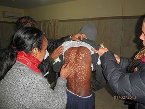 Alganesh esamina i segni delle torture subite da un profugo eritreo, durante uno dei viaggi in Sinai per cercare di liberarli dai sequestratori.