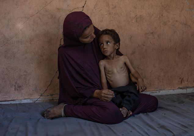 Gaza to hunger, meanwhile France announces that it will recognize the Palestinian state